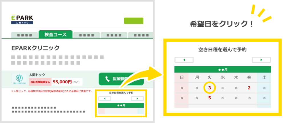 対象の自由診療メニューで予約